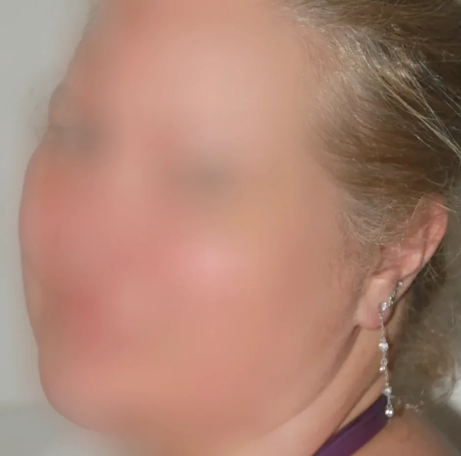 Chantal, 28